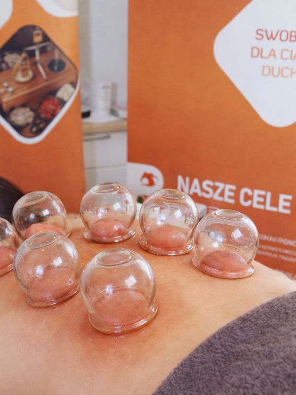 Zabieg bańki ogniowe 50 minut